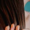 If You’re Losing Hair on a GLP-1, Here’s What Experts Want You to Know